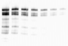 Xpress Blotting web-s.jpg